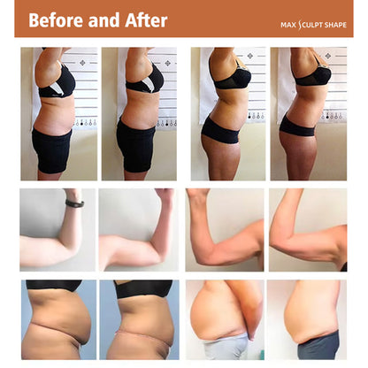 Salon Slimming Equipment Cold Laser Lipo + RF Firming Machine for Waist Abdomen