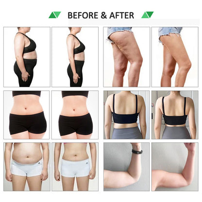 Body Contouring Machine with Cryolipolysis Cooling Plate and EMS Muscle Stimulation