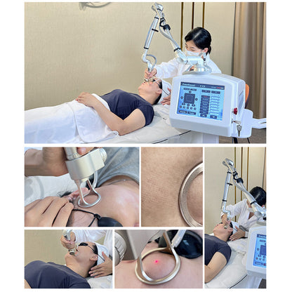 High Power CO₂ Laser for Skin Tightening Wrinkle Reduction and Acne Scar Therapy