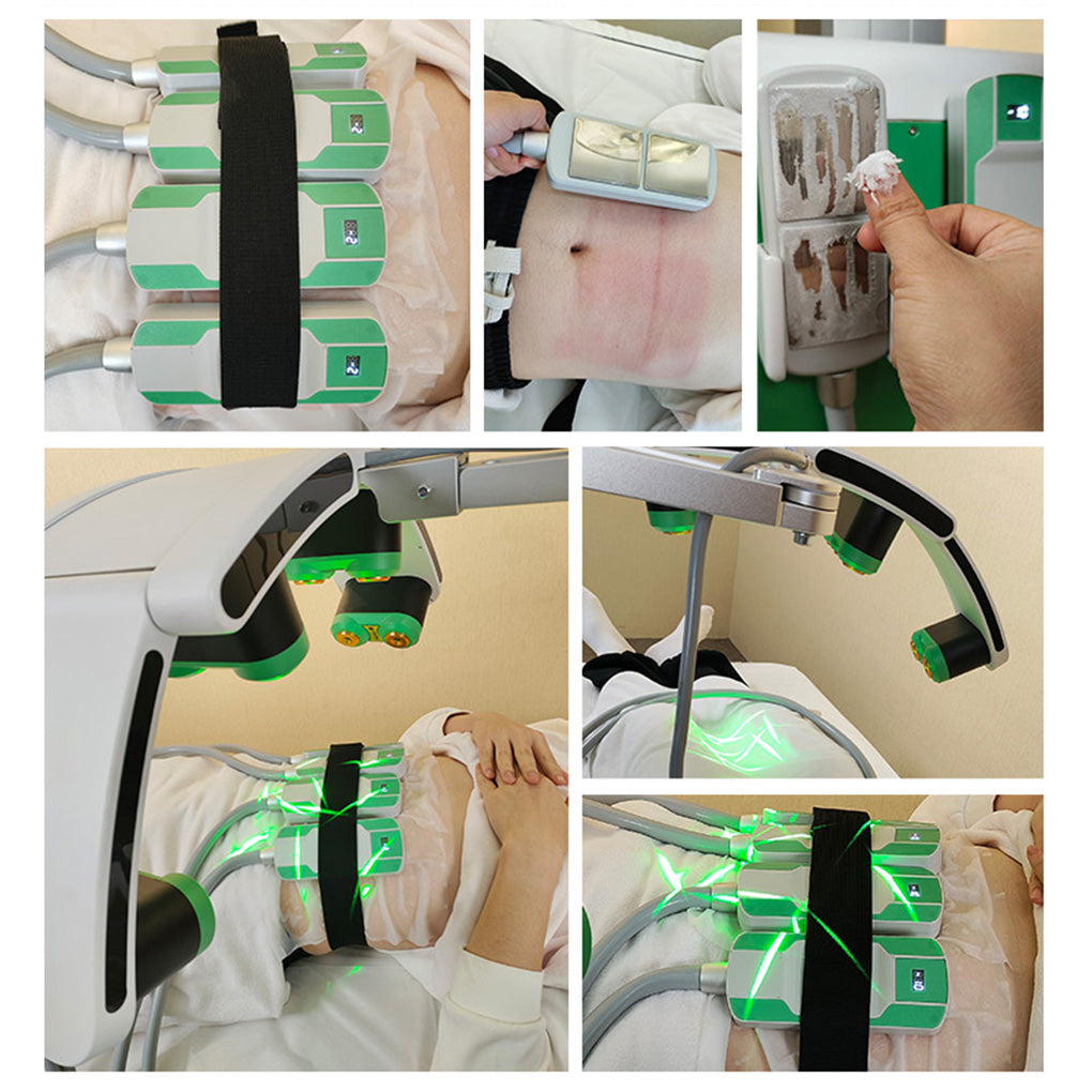 Salon Fat Freezing Machine with Lipolysis Laser and EMS Muscle Sculpting Function