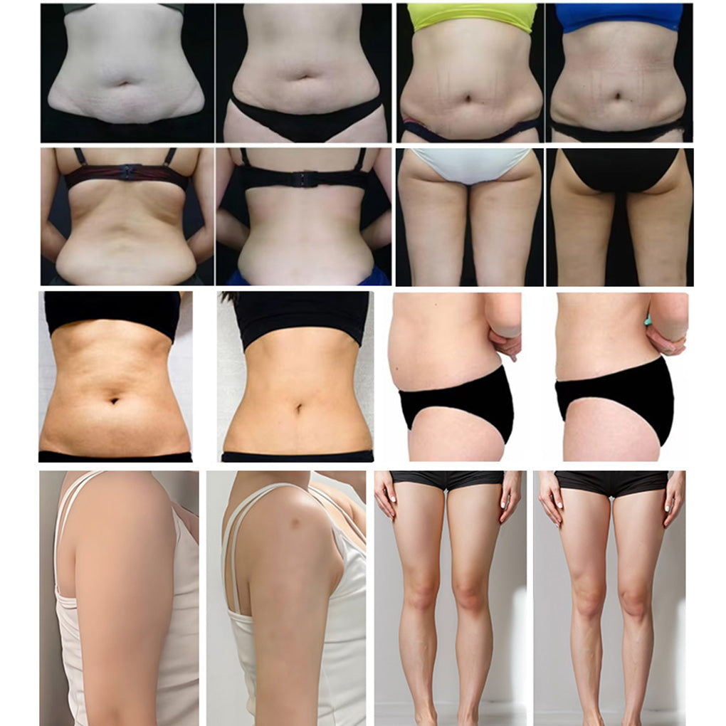 Cryolipolysis Pads Magnetic Therapy EMS 3 in 1 Body Contouring Machine Factory Direct Supply