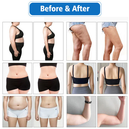 Cryo Fat Freezing Plate Machine with EMS + Laser Lipolysis for Distributor Supply