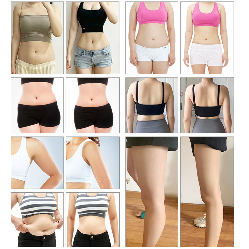 Professional Microwave RF Slimming Machine for Non-Surgical Fat Removal